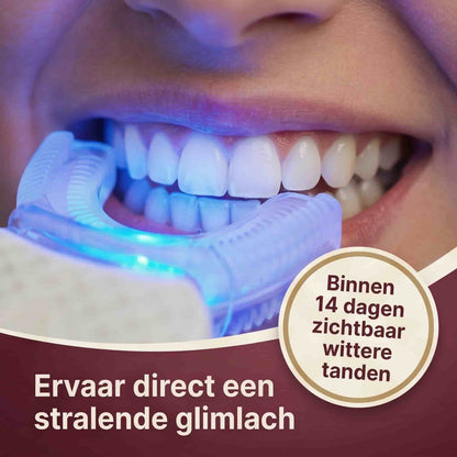 SmileV 2.0 – Verhelder je glimlach en straal met vertrouwen